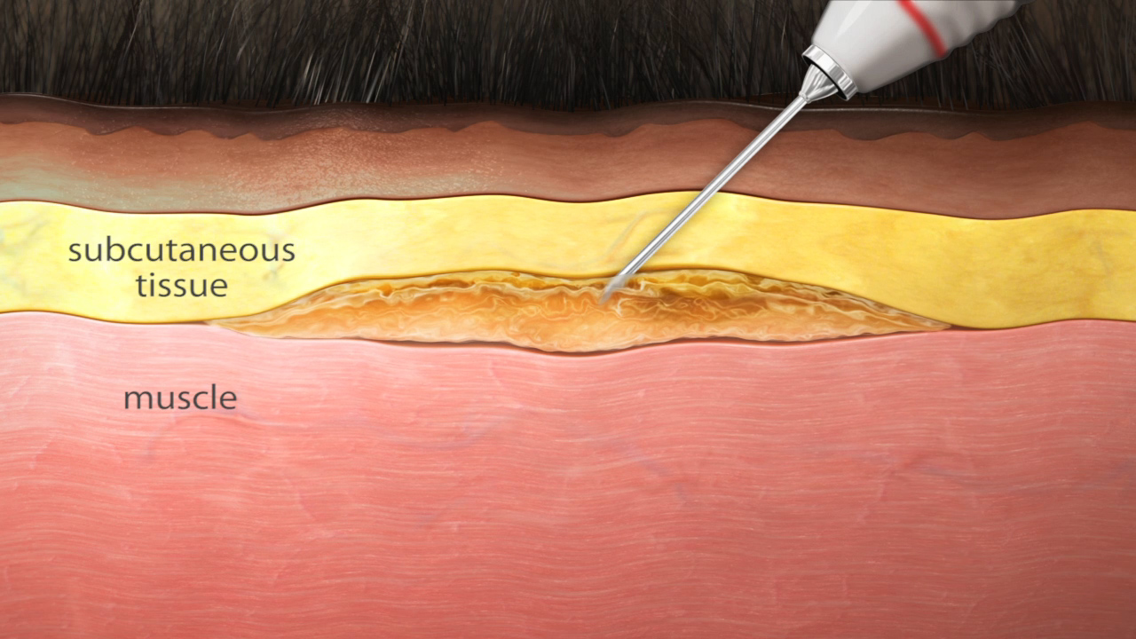 Animal Health Injection 3D